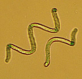 Spirulina under a microscope microscope image of spirulina